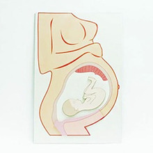 오픈메디칼태양 임신과 출산판 - 보건 교육