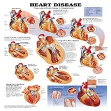 오픈메디칼[5%적립] 심장질병차트(9912)