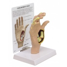 오픈메디칼GPI 손 골관절염 모형 G193
