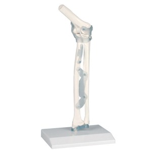 오픈메디칼ZIMMER 팔꿈치 관절 모형 (인대포함) 4554