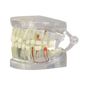 오픈메디칼GPI 투명 치아모형 G2861
